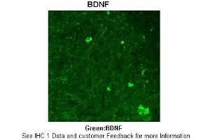 Sample Type :  Rhesus macaque spinal cord  Primary Antibody Dilution :  1:300  Secondary Antibody :  Donkey anti Rabbit 488  Secondary Antibody Dilution :  1:500  Color/Signal Descriptions :  Green: BDNF  Gene Name :  BDNF  Submitted by :  Timur Mavlyutov, Ph. (BDNF antibody  (Middle Region))