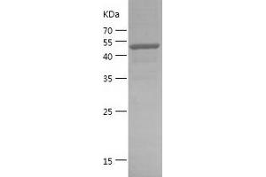 Western Blotting (WB) image for TGF-beta Activated Kinase 1/MAP3K7 Binding Protein 3 (TAB3) (AA 521-712) protein (GST tag) (ABIN7281784) (TAB3 Protein (AA 521-712) (GST tag))