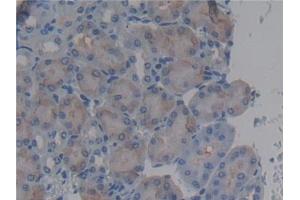 Detection of BPI in Mouse Kidney Tissue using Polyclonal Antibody to Bactericidal/Permeability Increasing Protein (BPI) (BPI antibody  (AA 320-457))