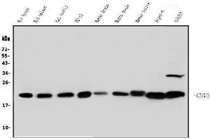 Western blot analysis of HP1 gamma using anti-HP1 gamma antibody (ABIN5693033). (CBX3 antibody  (AA 2-183))