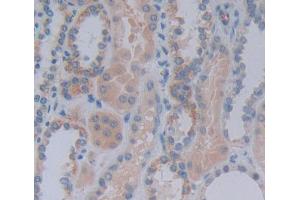 Used in DAB staining on fromalin fixed paraffin- embedded Kidney tissue (Acylphosphatase 1, Erythrocyte (AA 1-99) antibody)