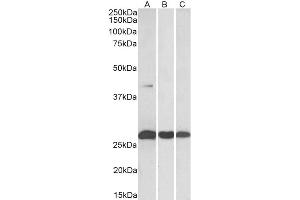Western Blotting (WB) image for anti-Dual Specificity Phosphatase 6 (DUSP6) antibody (ABIN5864212) (DUSP6 antibody)