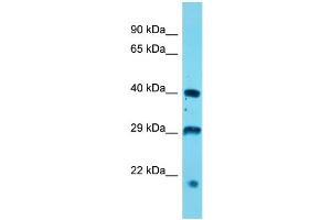 Host: Rabbit  Target Name: Usp12  Sample Tissue: Mouse Stomach lysates  Antibody Dilution: 1. (USP12 antibody  (N-Term))