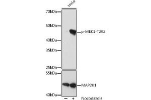 Western blot analysis of extracts of HeLa cells, using Phospho-MEK1-T292 pAb (ABIN7268635) at 1:1000 dilution or MK1 antibody (ABIN6134386, ABIN6143481, ABIN6143482 and ABIN7101408). (MEK1 antibody  (pThr292))