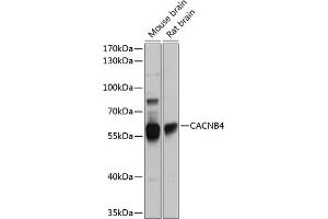 Western blot analysis of extracts of various cell lines, using C antibody (ABIN6130024, ABIN6137821, ABIN6137822 and ABIN6224970) at 1:1000 dilution. (CACNB4 antibody  (AA 401-520))