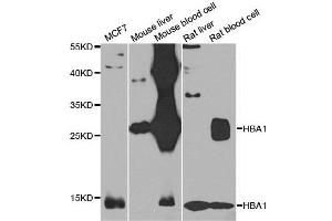 Western blot analysis of extracts of various cell lines, using HBA1 antibody. (HBA1 antibody)