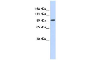 WB Suggested Anti-ZNF512B Antibody Titration: 0. (ZNF512B antibody  (Middle Region))