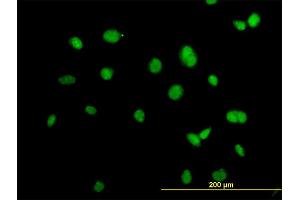 Immunofluorescence (IF) image for anti-Actinin, alpha 4 (ACTN4) (AA 592-701) antibody (ABIN559759)