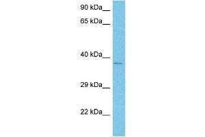 Host:  Rabbit  Target Name:  NOX4  Sample Tissue:  Human 786-0 Whole Cell  Antibody Dilution:  1ug/ml (NADPH Oxidase 4 antibody  (Middle Region))