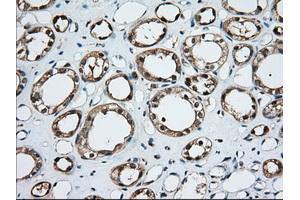 Immunohistochemical staining of paraffin-embedded Human liver tissue using anti-TBXAS1 mouse monoclonal antibody. (TBXAS1 antibody)