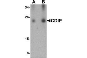 Western Blotting (WB) image for anti-LITAF-Like Protein (CDIP1) (Middle Region) antibody (ABIN1030904) (CDIP1 antibody  (Middle Region))
