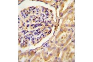 Immunohistochemistry (Paraffin-embedded Sections) (IHC (p)) image for anti-Guanine Nucleotide Binding Protein (G Protein), alpha Transducing Activity Polypeptide 2 (GNAT2) (AA 140-169), (Middle Region) antibody (ABIN952564)