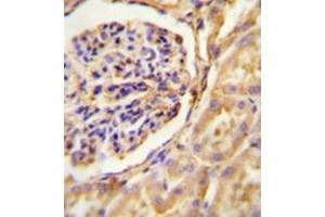 Immunohistochemistry analysis in formalin fixed and paraffin embedded human Kidney tissue reacted with GNAT2 / GNATC Antibody (Center) Cat.