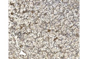 IHC analysis of EIF3C using anti-EIF3C antibody (ABIN7602528). (EIF3C antibody  (AA 81-637))