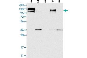 Western blot analysis of Lane 1: RT-4, Lane 2: U-251 MG, Lane 3: Human Plasma, Lane 4: Liver, Lane 5: Tonsil with CGN polyclonal antibody  at 1:250-1:500 dilution. (Cingulin antibody)
