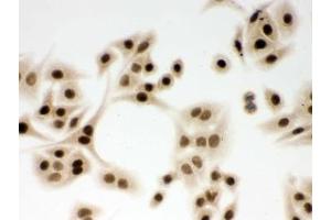 Immunocytochemistry (ICC) image for anti-Damage Specific DNA Binding Protein 1 (DDB1) (AA 1011-1140) antibody (ABIN4950780)