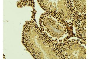 ABIN6276363 at 1/100 staining Mouse testis tissue by IHC-P. (CARD8 antibody)
