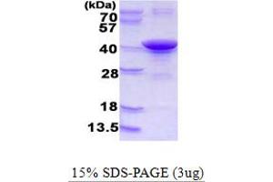 SDS-PAGE (SDS) image for Low Density Lipoprotein Receptor Adaptor Protein 1 (LDLRAP1) (AA 1-308) protein (His tag) (ABIN668020)