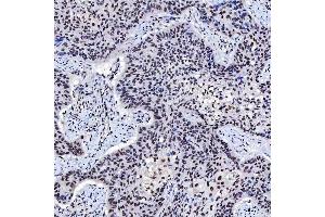 IHC analysis of SNRNP200 using anti-SNRNP200 antibody (ABIN7602032). (SNRNP200 antibody  (AA 557-2129))