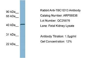WB Suggested Anti-TBC1D13  Antibody Titration: 0. (TBC1D13 antibody  (Middle Region))