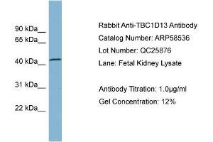 WB Suggested Anti-TBC1D13  Antibody Titration: 0.