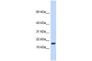HERC4 antibody used at 1 ug/ml to detect target protein. (HERC4 antibody  (N-Term))