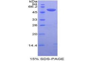 SDS-PAGE (SDS) image for Plasminogen Activator, Tissue (PLAT) (AA 311-562) protein (His tag,GST tag) (ABIN1877837) (PLAT Protein (AA 311-562) (His tag,GST tag))