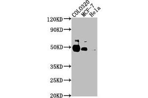 Western Blot Positive WB detected in: COLO320 whole cell lysate, MCF-7 whole cell lysate, Hela whole cell lysate All lanes: KRT20 antibody at 1:2000 Secondary Goat polyclonal to rabbit IgG at 1/50000 dilution Predicted band size: 49 kDa Observed band size: 49 kDa (Keratin 2 antibody  (AA 207-424))