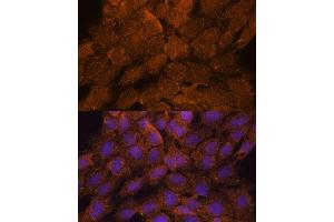 Immunofluorescence analysis of C6 cells using TNFL2 antibody (ABIN6133093, ABIN6149298, ABIN6149299 and ABIN6217788) at dilution of 1:100. (TNFAIP8L2 antibody  (AA 1-184))