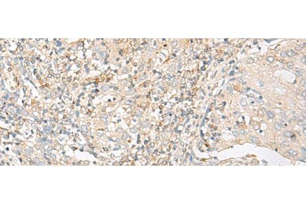 GLIS1 antibody