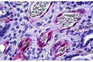 Human Placenta, Vessels: Formalin-Fixed, Paraffin-Embedded (FFPE) (BMX antibody  (AA 11-60))