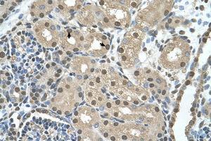 Image no. 1 for anti-Shwachman-Bodian-Diamond Syndrome (SBDS) (AA 51-100) antibody (ABIN205087) (SBDS antibody  (AA 51-100))
