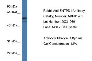 Western Blotting (WB) image for anti-Ectonucleoside Triphosphate diphosphohydrolase 1 (ENTPD1) (N-Term) antibody (ABIN2788738) (CD39 antibody  (N-Term))