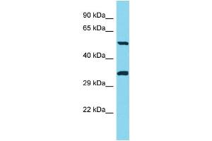 Host: Rabbit Target Name: PNLIPRP3 Sample Type: Jurkat Whole Cell lysates Antibody Dilution: 1. (PNLIPRP3 antibody  (C-Term))