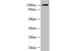 Western blot All lanes: SLC4A8 antibody at 2 μg/mL + Hela whole cell lysate Secondary Goat polyclonal to rabbit IgG at 1/10000 dilution Predicted band size: 123, 121, 118, 112, 78, 84, 72 kDa Observed band size: 123 kDa (SLC4A8 antibody  (AA 1-300))