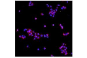IF analysis of PDE6 beta/PDE6B using anti-PDE6 beta/PDE6B antibody (ABIN7600894). (PDE6B antibody  (AA 25-237))