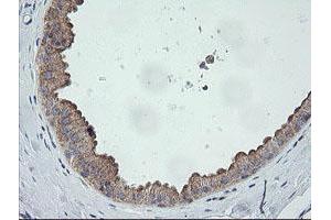 Image no. 6 for anti-Chromosome 2 Open Reading Frame 62 (C2orf62) antibody (ABIN1497054) (C2orf62 antibody)