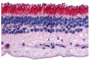 Immunohistochemical (Formalin/PFA-fixed paraffin-embedded sections) staining in human retina with PTPRM polyclonal antibody . (PTPRM antibody)