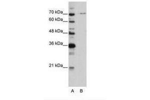 Image no. 1 for anti-PRP3 Pre-mRNA Processing Factor 3 Homolog (PRPF3) (AA 63-112) antibody (ABIN6736204) (PRPF3 antibody  (AA 63-112))