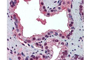 Anti-PABPN1 antibody IHC of human prostate.