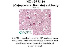 Image no. 1 for anti-G Protein-Coupled Receptor 119 (GPR119) (3rd Cytoplasmic Domain) antibody (ABIN1734912) (G Protein-Coupled Receptor 119 antibody  (3rd Cytoplasmic Domain))