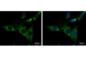 ICC/IF Image NDUFS3 antibody detects NDUFS3 protein at mitochondria by immunofluorescent analysis. (NDUFS3 antibody  (Center))