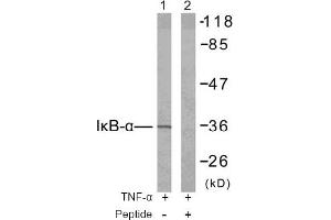 Image no. 2 for anti-Nuclear Factor of kappa Light Polypeptide Gene Enhancer in B-Cells Inhibitor, alpha (NFKBIA) (Tyr42) antibody (ABIN197390) (NFKBIA antibody  (Tyr42))