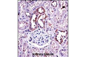 M-CSF Antibody (Center) ((ABIN390719 and ABIN2840996))immunohistochemistry analysis in formalin fixed and paraffin embedded human kidney tissue followed by peroxidase conjugation of the secondary antibody and DAB staining.
