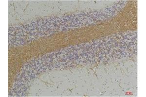 Immunohistochemistry (IHC) analysis of paraffin-embedded Rat Brain Tissue using GABA A Receptor alpha2 Rabbit Polyclonal Antibody diluted at 1:200. (GABRA2 antibody)