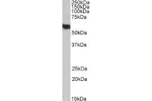 Biotinylated ABIN4902505 (1µg/ml) staining of Human Liver lysate (35µg protein in RIPA buffer), exactly mirroring its parental non-biotinylated product. (FTCD antibody  (N-Term) (Biotin))