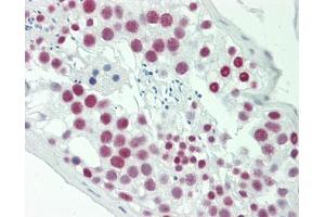 Human Testis: Formalin-Fixed, Paraffin-Embedded (FFPE) (SAFB antibody  (C-Term))