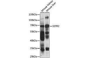 Western blot analysis of extracts of various cell lines, using SSTR2 antibody (ABIN6291365) at 1:1000 dilution. (SSTR2 antibody)