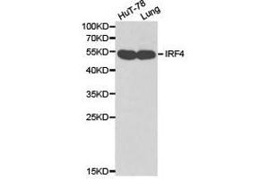Western Blotting (WB) image for anti-Interferon Regulatory Factor 4 (IRF4) antibody (ABIN1873272) (IRF4 antibody)