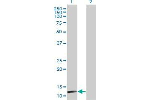 NUDT8 antibody  (AA 1-140)